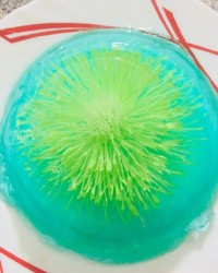 اولین ژله تزریقی من راحت بود