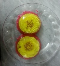 آرشیوی از اولین تجربه ژله تزریقی